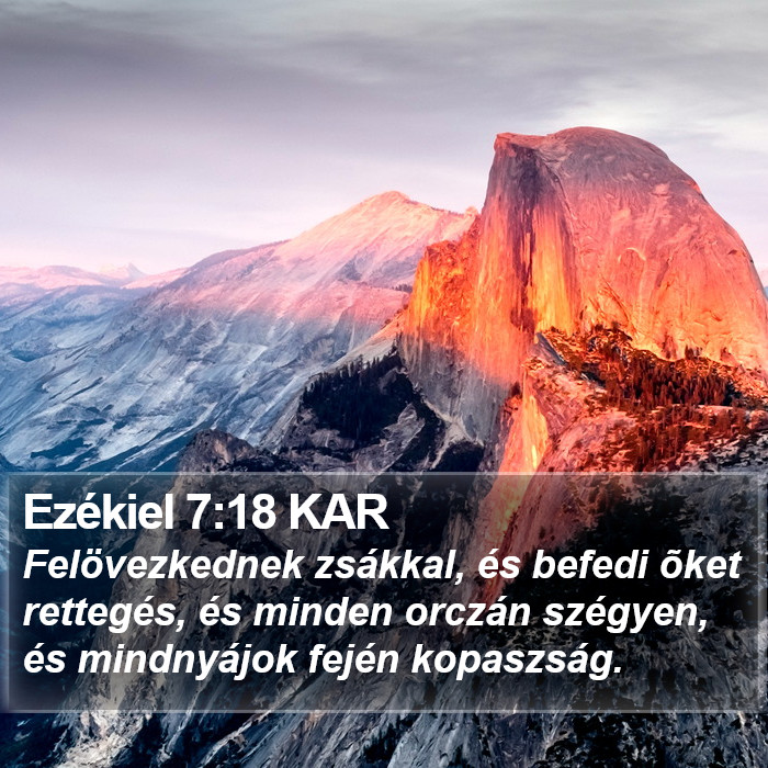 Ezékiel 7:18 KAR Bible Study